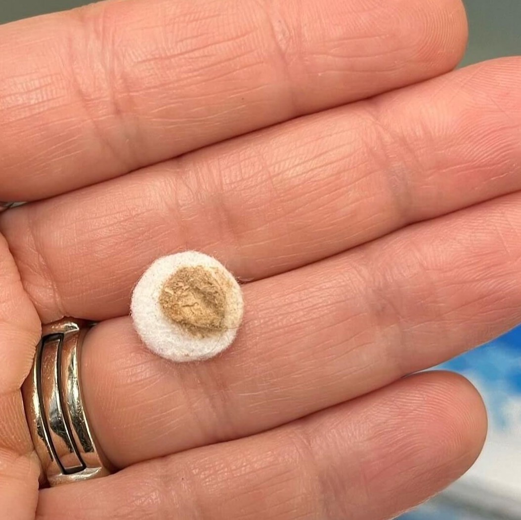 Dead skin after treatment